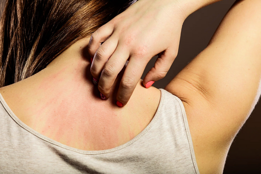 5 quick ways to find out if you're allergic to certain foods