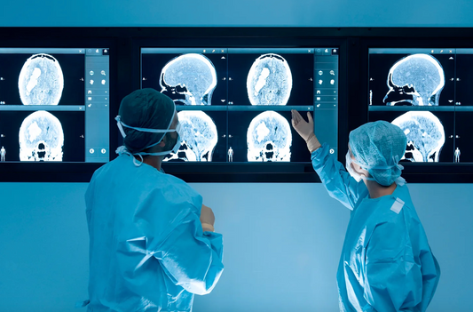 12 ways to reduce your chances of having a stroke 15